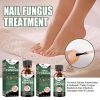 EELHOE Nail Care Solution For Nail Surface Thick Nails Soft Nails Gentle Cleansing And Moisturizing Solution